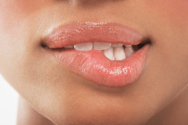 前歯が大きいのは歯列矯正で治せる 治療方法と費用について 葛西モア矯正歯科 葛西駅から徒歩0分 西葛西駅も徒歩圏内 江戸川区の矯正治療専門歯科医院